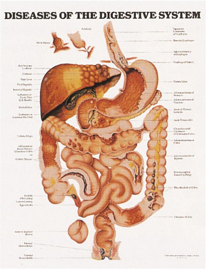 Wall Chart - Diseases of the Digestive System - (Single)